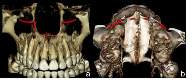 Figura 3