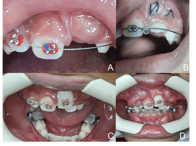 Figure 4.